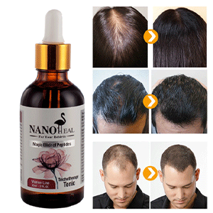 Anti-hair-loss-and-regrowth-solution-without-minoxidil-min