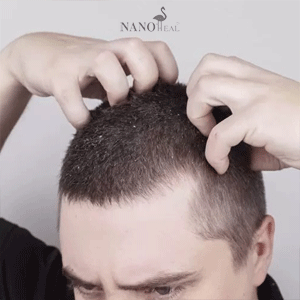 Get-rid-of-itchy-head-in-simple-ways-min